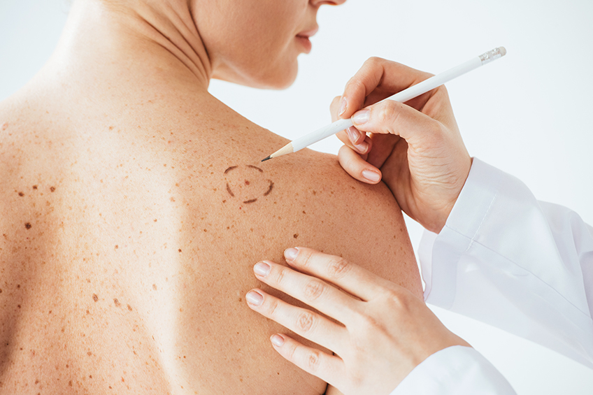 Poliambulatori Primavera - Dermatologo - visita Dermatologica